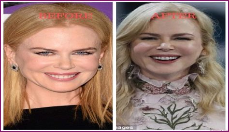 Nicole Kidman's 